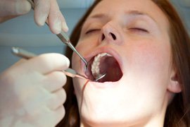 A woman getting her teeth cleaning done