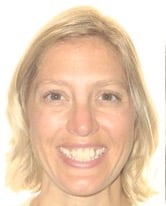 Photo of a patient's teeth before Orthodontics, Teeth Whitening and Dental Implants Treatment at Tonka Smiles Minnetonka