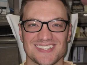 Photo of a patient before getting an Implant Bridge & Veneer