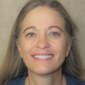 Jackie after treatment headshot